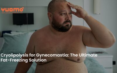 Cryolipolysis for Gynecomastia: The Ultimate Fat-Freezing Solution