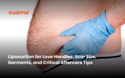 Liposuction for Love Handles: Scar Size, Garments, and Critical Aftercare Tips