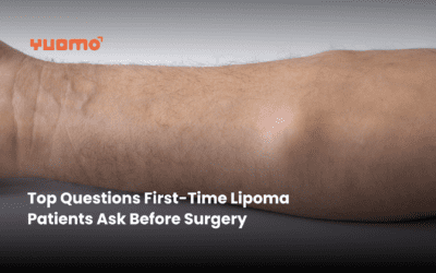 Top Questions First-Time Lipoma Patients Ask Before Surgery