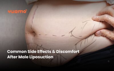 Common Side Effects & Discomfort After Male