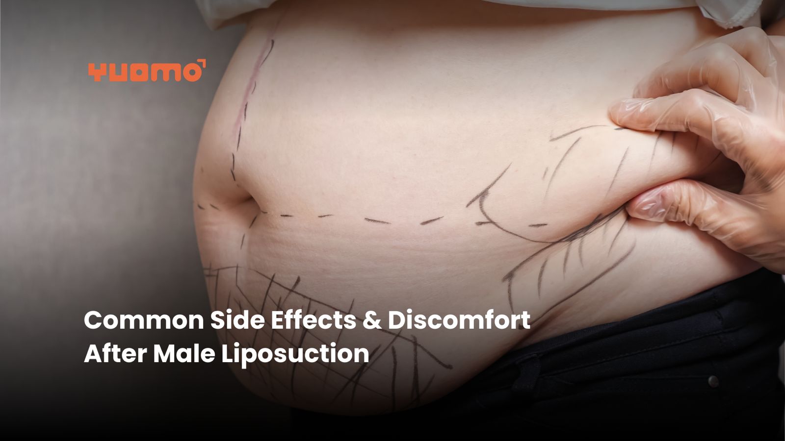 Ovarian Rejuvenation - Delhi IVF
