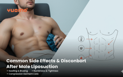 Common Side Effects & Discomfort After Male Liposuction