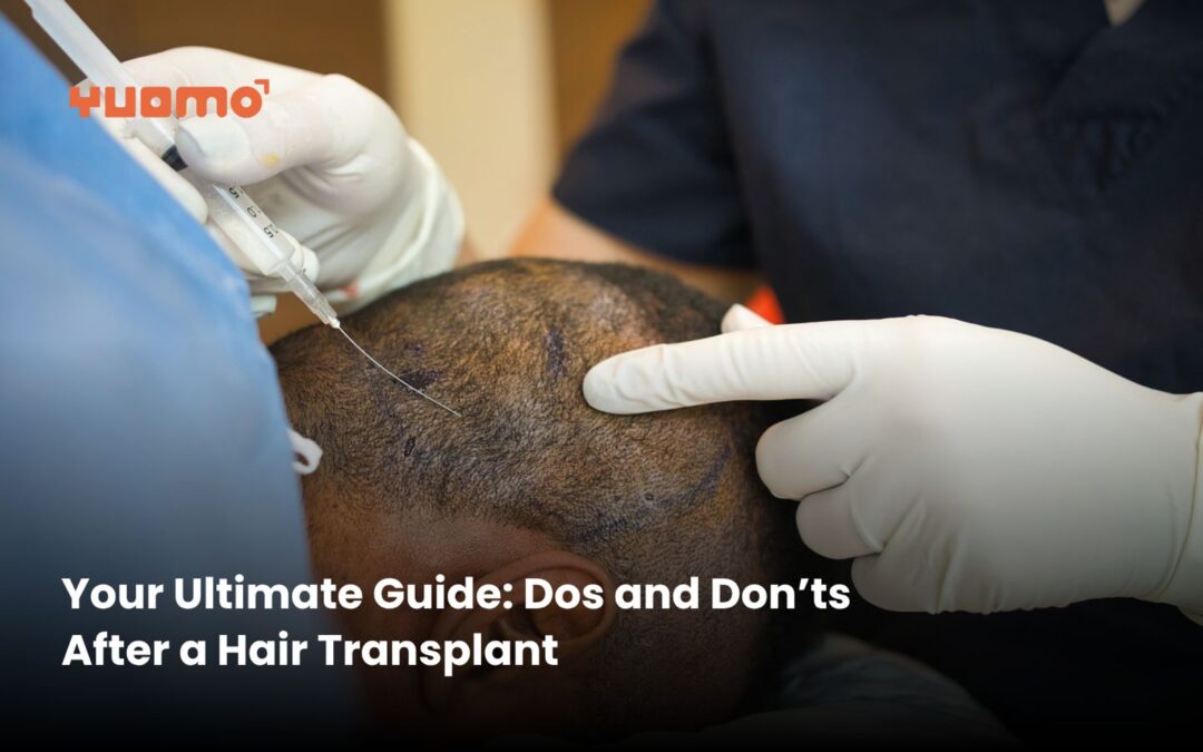 Your Ultimate Guide: Dos and Don’ts After a Hair Transplant
