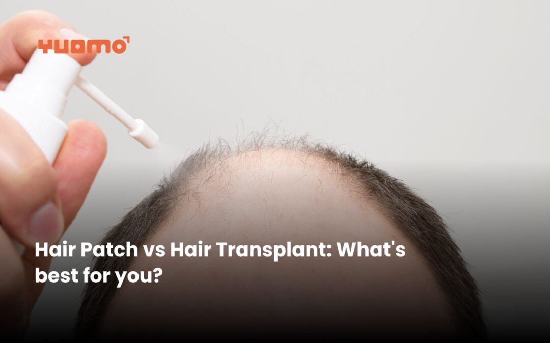 Hair patch vs Hair transplant: What is best for you?