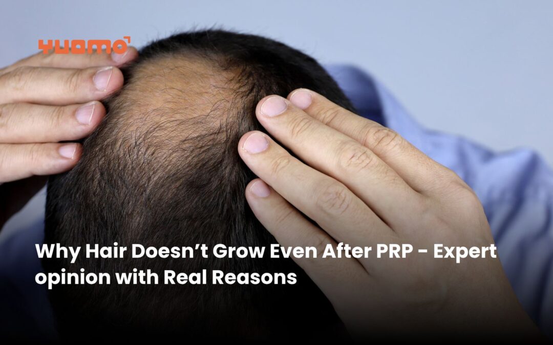 Why Hair Doesn’t Grow Even After PRP – Expert opinion with Real Reasons
