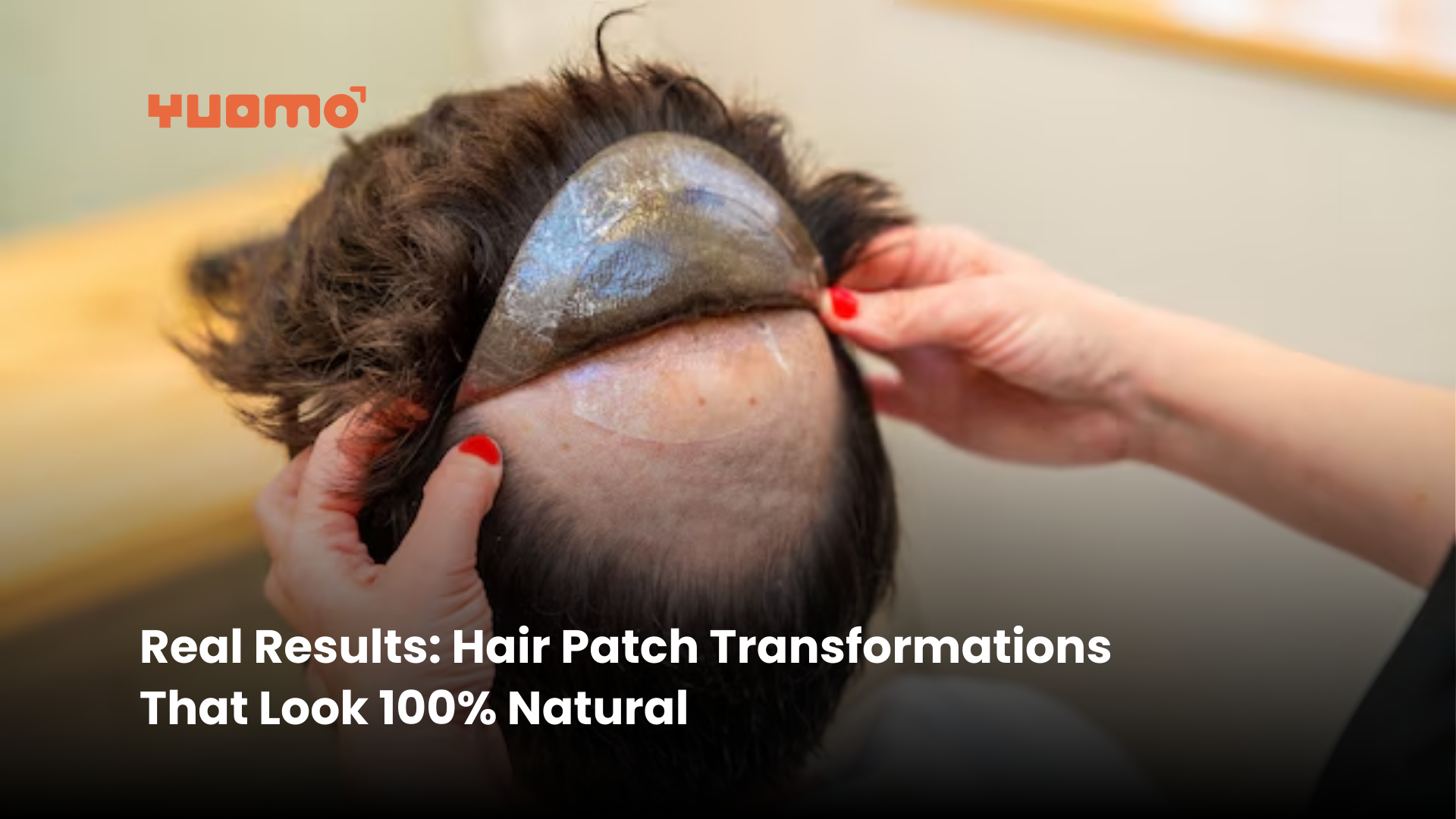 Ovarian Rejuvenation - Delhi IVF