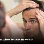 Hair Loss Before 20: Is It Normal? Why Young Men Are Losing Hair Early