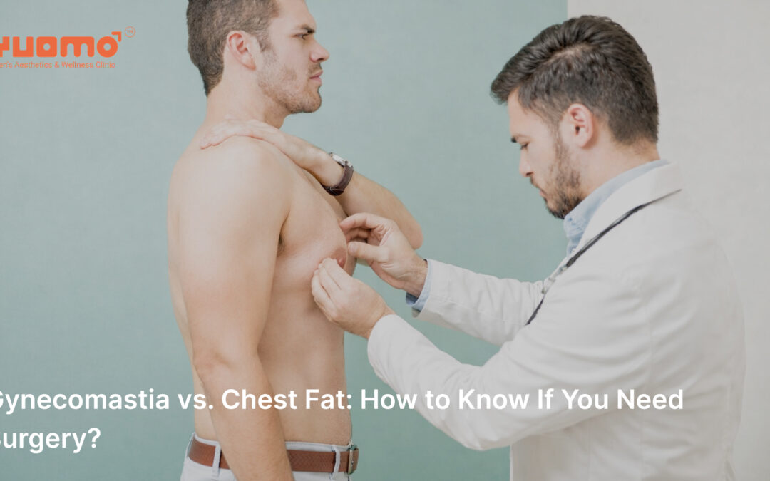 Gynecomastia vs. Chest Fat: How to Know If You Need Surgery?