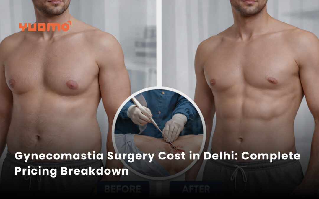 Gynecomastia Surgery Cost in Delhi: Complete Pricing Breakdown