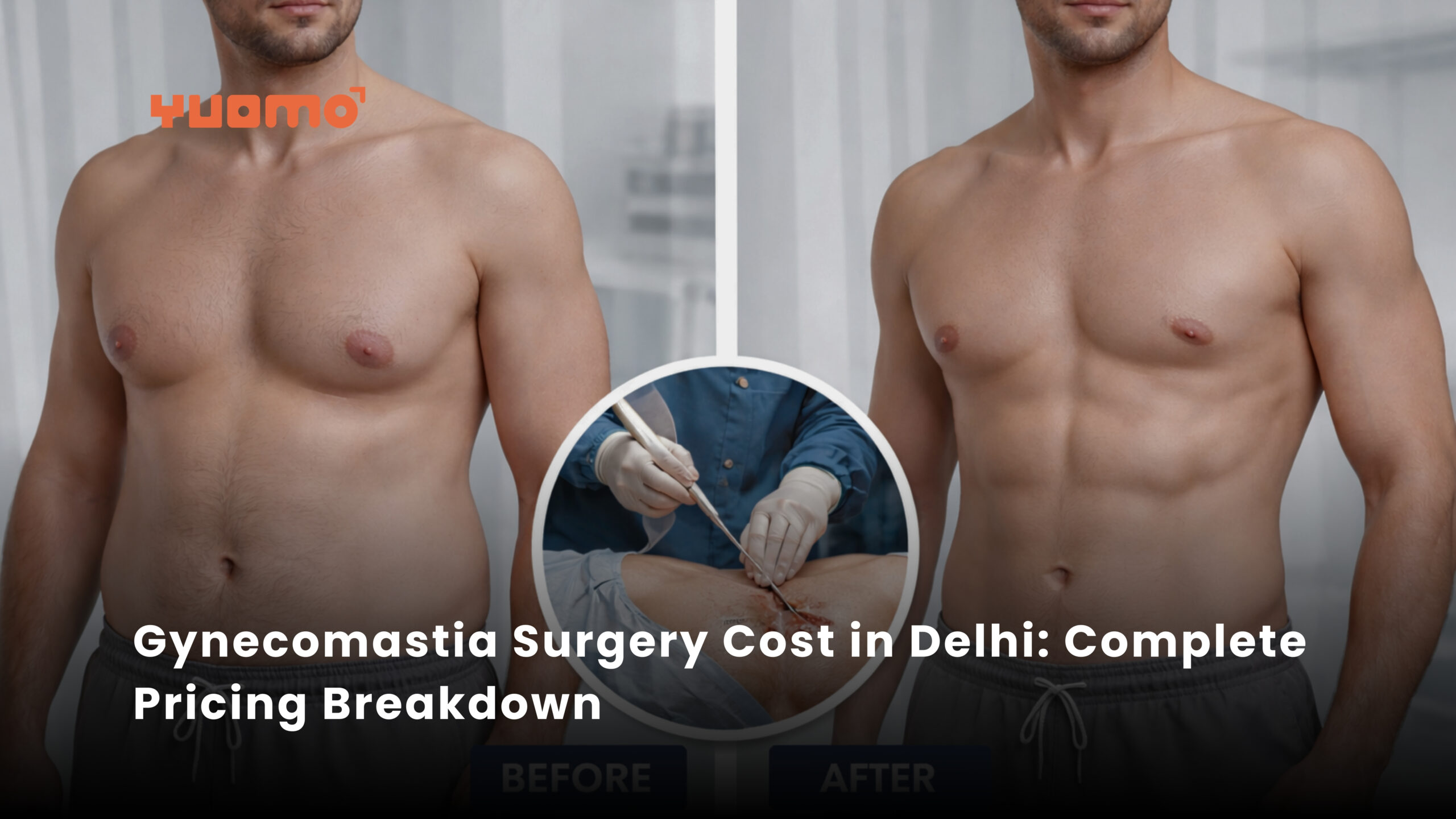 Ovarian Rejuvenation - Delhi IVF