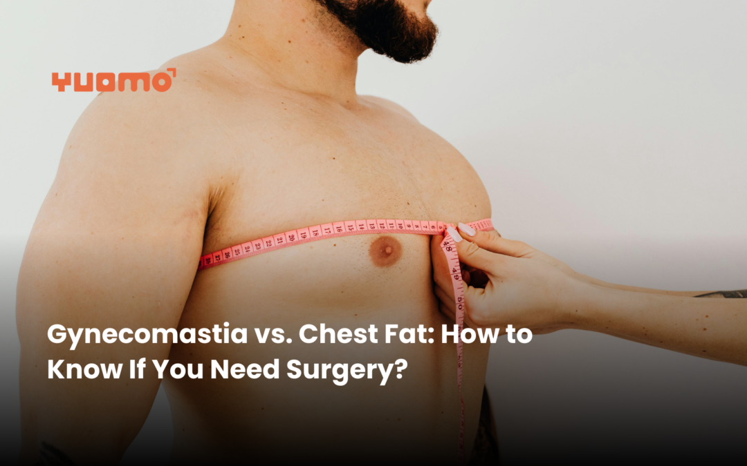 Gynecomastia vs. Chest Fat: How to Know If You Need Surgery?