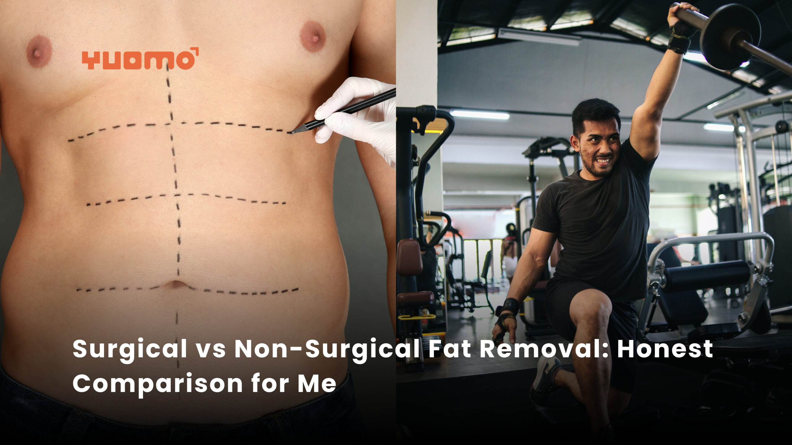 Ovarian Rejuvenation - Delhi IVF Ovarian Rejuvenation - Delhi IVF