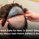 Is Hair Patch Safe for Men in Delhi? What Real Users Say About Hair Patch Safety & Results